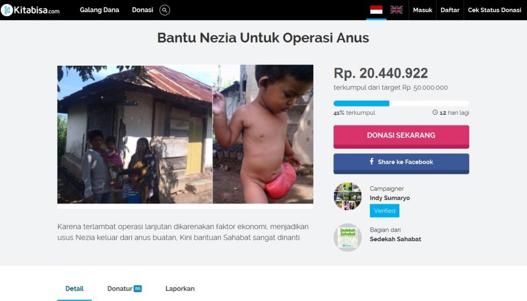 Donasi untuk Balita Nezia - TDA Peduli